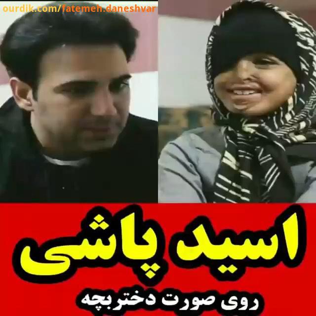 رعنا کودکی که از سوی پدرش مورد اسید پاشی قرار گرفت مادرش را از دست داد بعد از هفت سال رنج همچنان