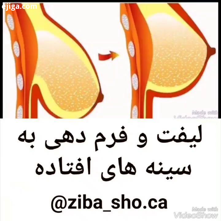 ...لیفت سینه ماساژ سینه فرم دادن به سینه بزرگ کردن سینه کوچیک کردن سینه پروتز سینه