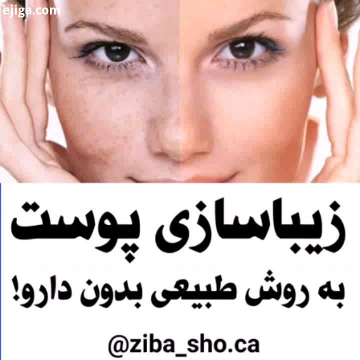 مرسی که میکنید مرحله اگر پست رو دوست داشتین رو برام بزنید.