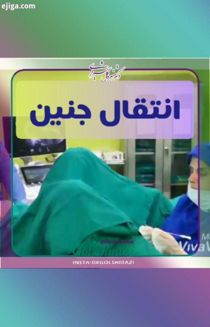 ...انتقال جنین توسط دکتر گلشیرازی در مرکز آی وی اف نیکان...آدرس تهران تهرانپارس بین فلکه دوم سوم