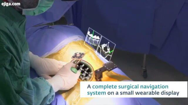 .ابزار جراحی واقعیت افزوده که به جراحان دید اشعه ایکس می دهد به زودی فناوری واقعیت افزوده با سامانه