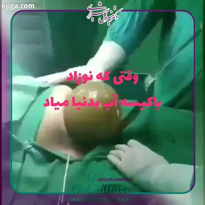 شماره تماس جهت مراجعه ویزیت حضورى: ٧٧٨٧٧٥١٣ ٠٢١ در صورت امکان صفحه اینستاگرام را دنبال کرده به