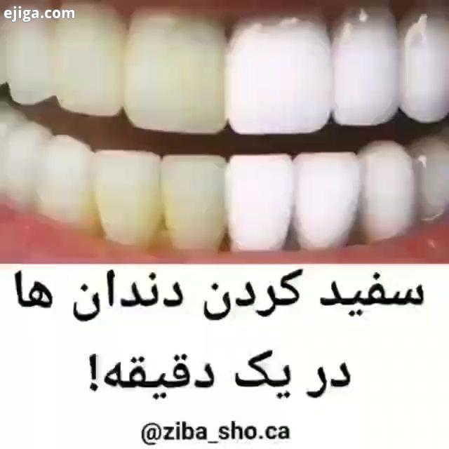 .بچه ها مسواکی که برای این کار استفاده میکنید یه مسواک جداگانه باشه نه مسواکی که هر شب باهاش مسواک