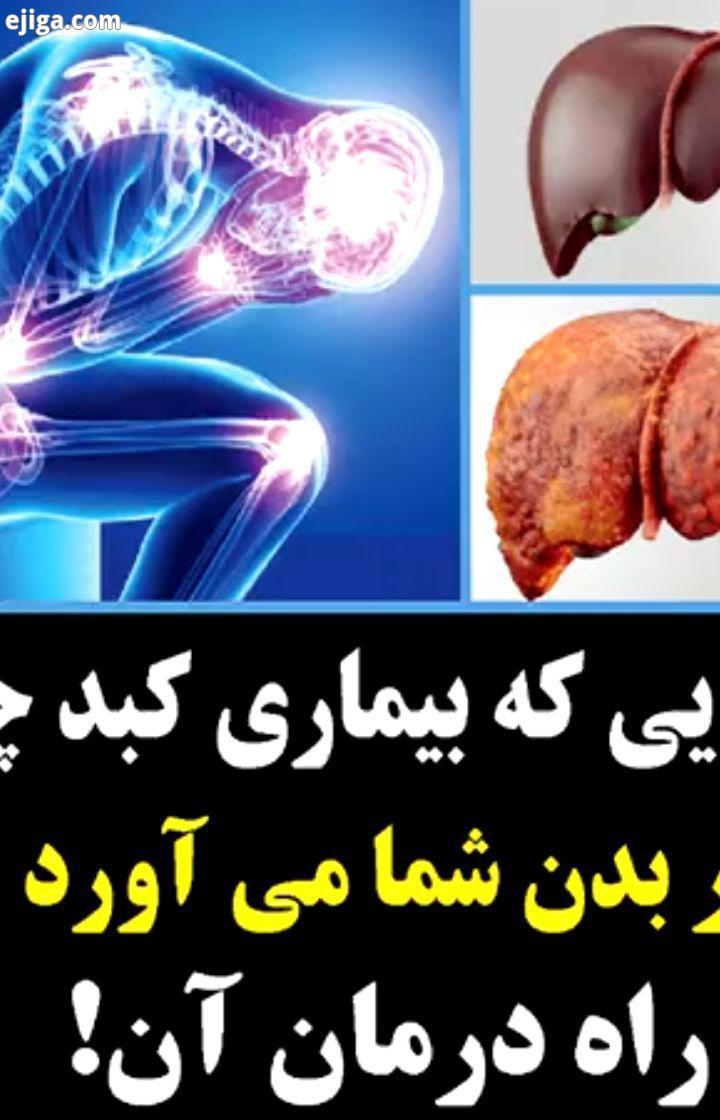 .تیزر بالا در مورد کبد چرب را ببینید به دیگران هم توصیه کنید farteb com..کبد چرب آنزیمهای کبد درما