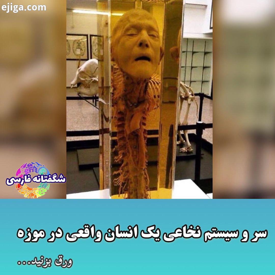 این پست داره، کدوم جالب تر بود جالب عجیب علمی پزشکی آب مروارید دانستنیهای جالب