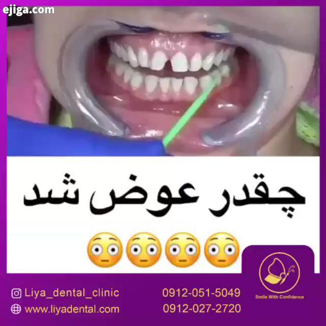 .در خوش نام ترین مجموعه کلینیک های دندانپزشکی غرب تهران جهت ایمپلنت کاشت دندان لمینت سرامیکی کامپو
