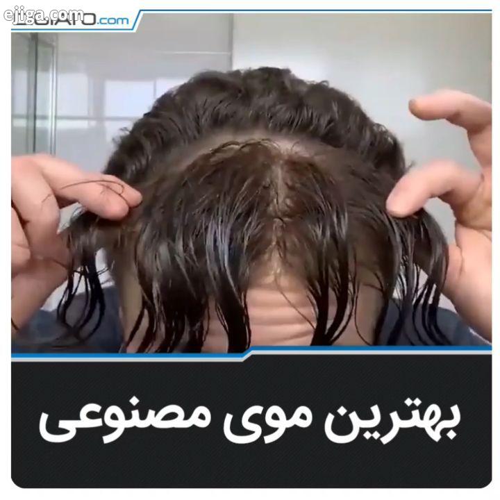 موی مصنوعی گزینه ای بهتر از کلاه گیس ها مو کاشت مو کلاه گیس مو مص