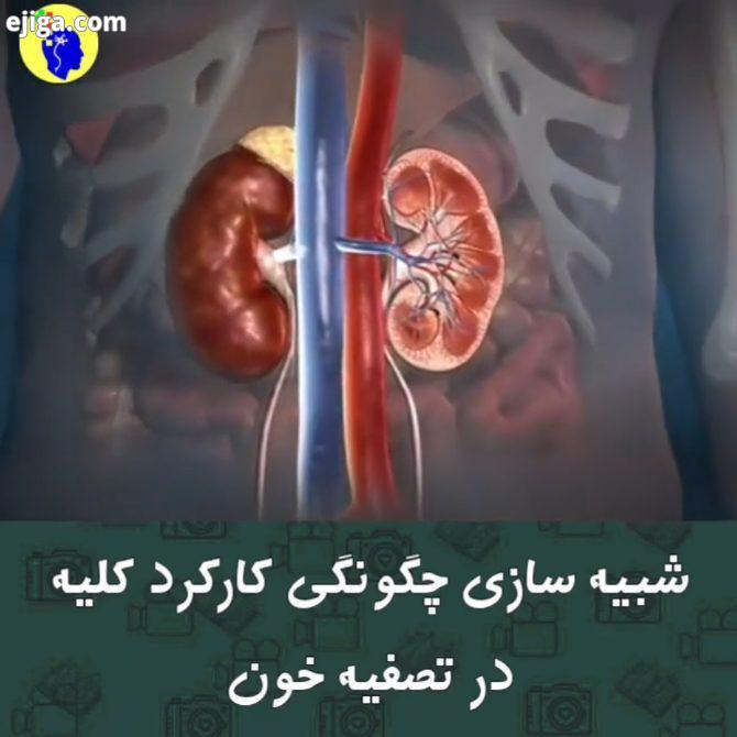 البته اگر سنگ نداشته باشید کلیه ها یک جفت عضو لوبیایی شکل قهوه ای رنگ می باشند که در طرفین ستون