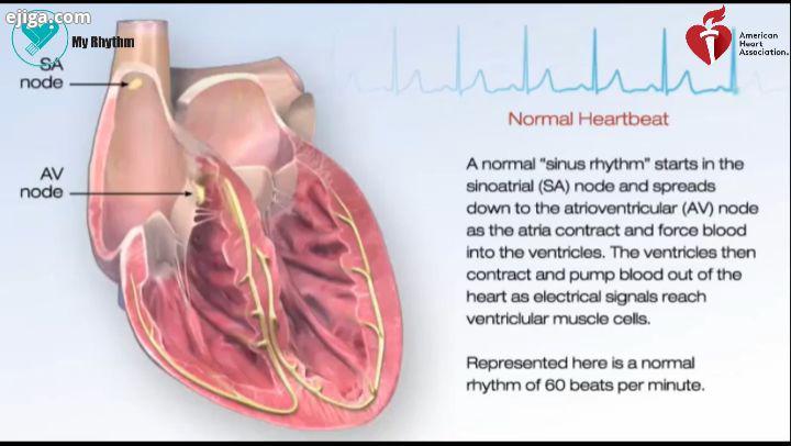 ساختار قلب برگرفته از سایت American heart association توضیحات فارسی از مای ریتم هولترهای قلب مای ریت