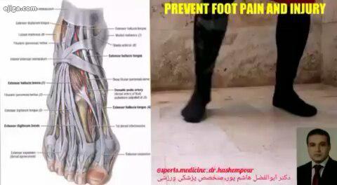PREVENT FOOT PAIN AND INJURY گوش کنید این پست را یک چهارم کل استخوانهای بدن انسان در foot قرار دارند