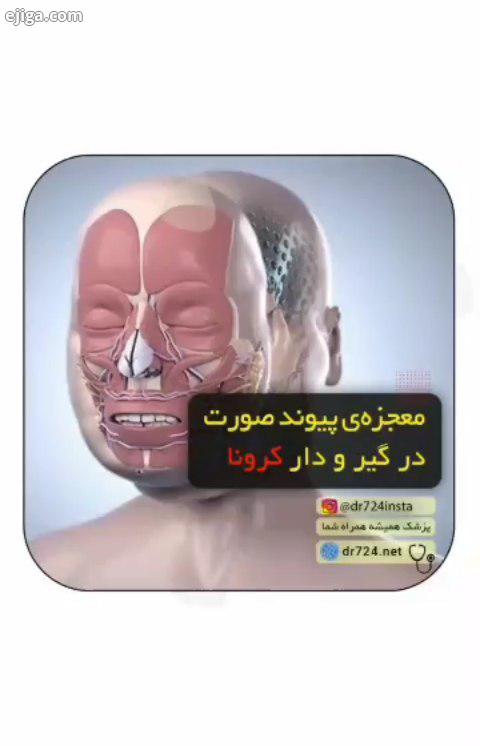 تجربه اولین پیوند دستها صورت به طور همزمان بی شک این حس، توصیف ناپذیره که زندگی رو برگردونی به افراد