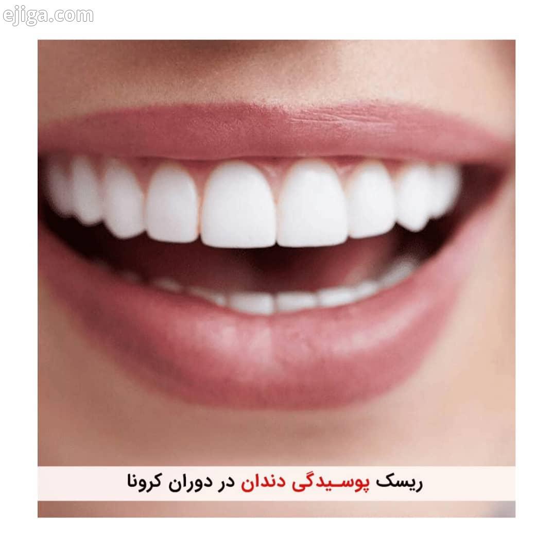 بهداشت دهان دندان در دوران کرونا باید بیشتر رعایت شود ماسک زدن باعث ایجاد پوسیدگی جدید دندانی نمی