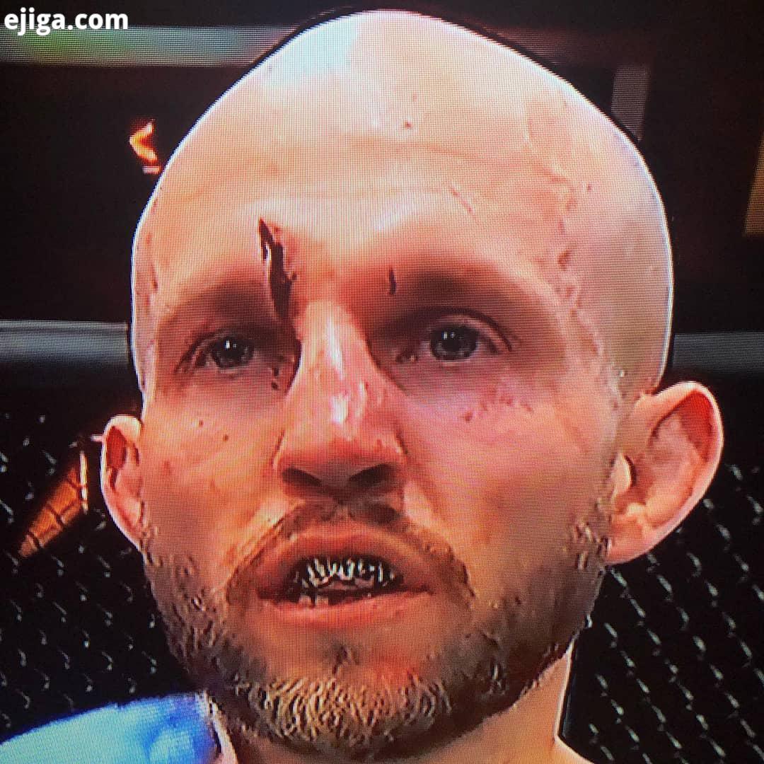MMA INJURY ALERT لسریشنی که ملاحظه می کنید در راند برای برایان کلهر اتفاق افتاد منجر به خونریزی