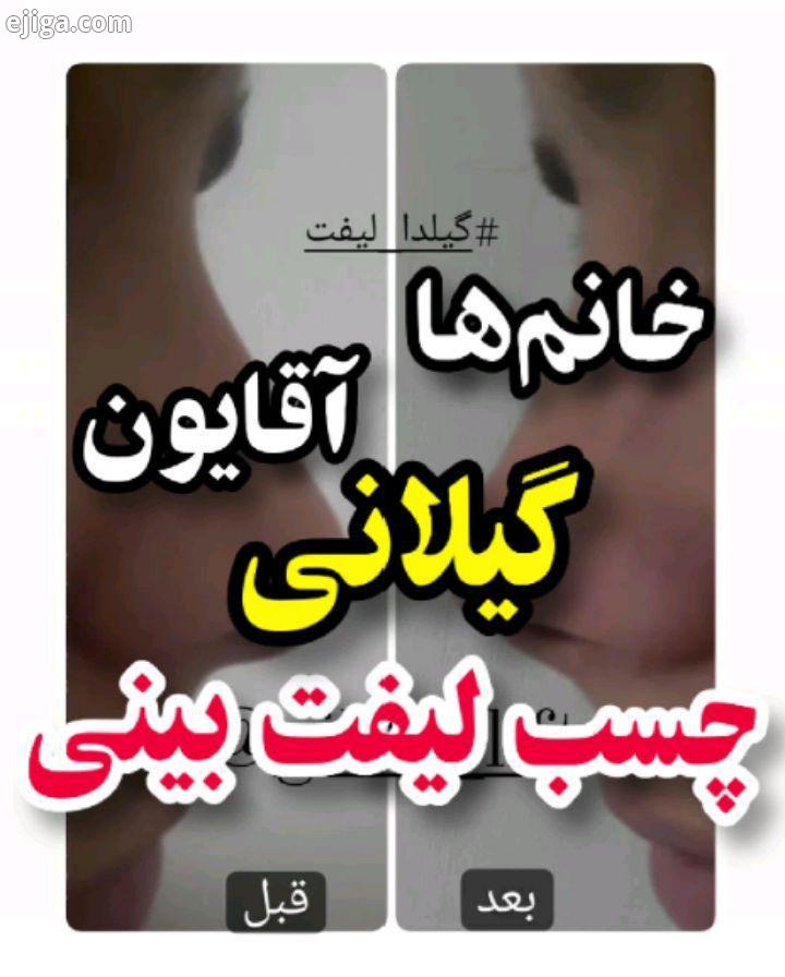 چسب لیفت بینی گیلدا ، بدون دردسر به بینیتون فرم بدین حتما میخوای بگی چطوری اطلاعات بیشتر تو کلیپ بال