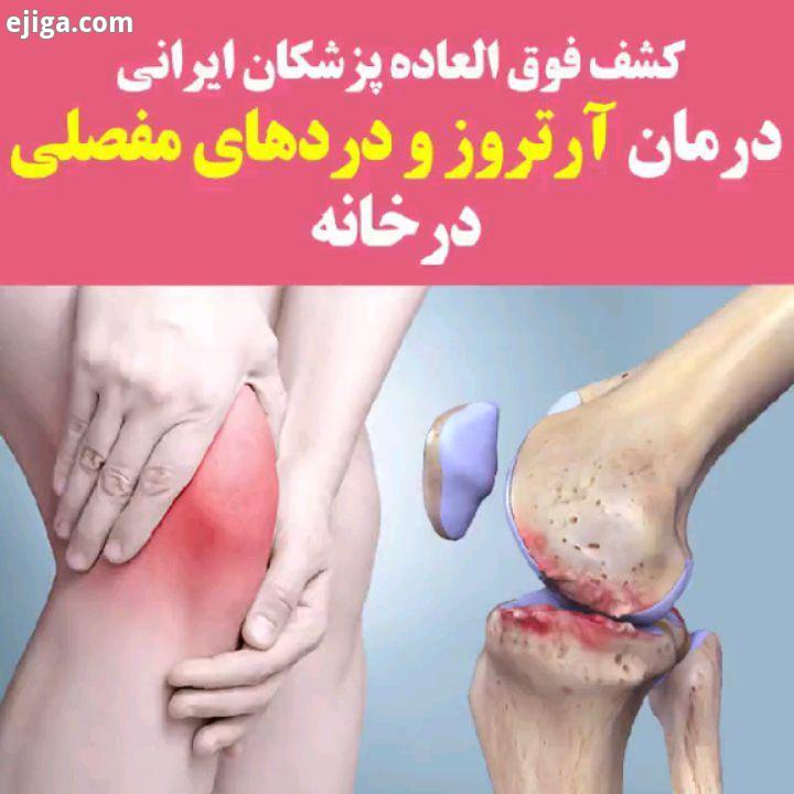 پایانی برای آرتروز درد های مفصلی محصولی که در اخبار صدا سیما تایید شده است اگر شما هم درد های مف