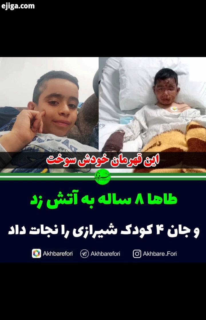 کودک فداکار با تلاش پزشکان شیرازی درمان از بیمارستان مرخص شد