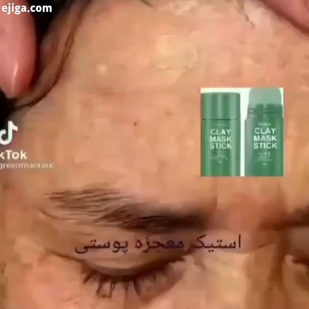 برای ثبت سفارش استیک ماسک مدیان به دایرکت ما پیام بدید این ماسک شگفت انگیز با استفاده آسان سریع تمام