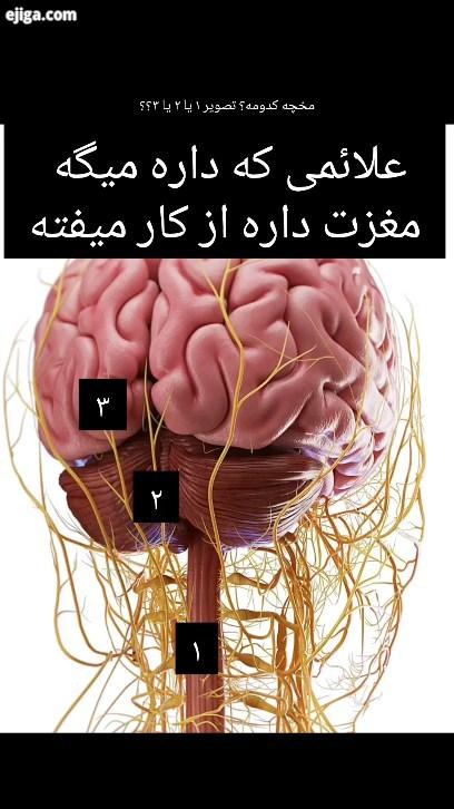 زمانی که سلول های مغزی یکی پس از دیگری نابود بشند ممکنه این مشکلات گفته شده داخل پست براتون بوجود بی